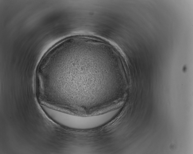 X0000094381295200711242014