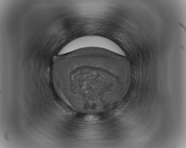 X0000094380319200711301406