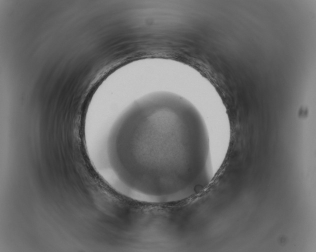 X0000094420146200712061059