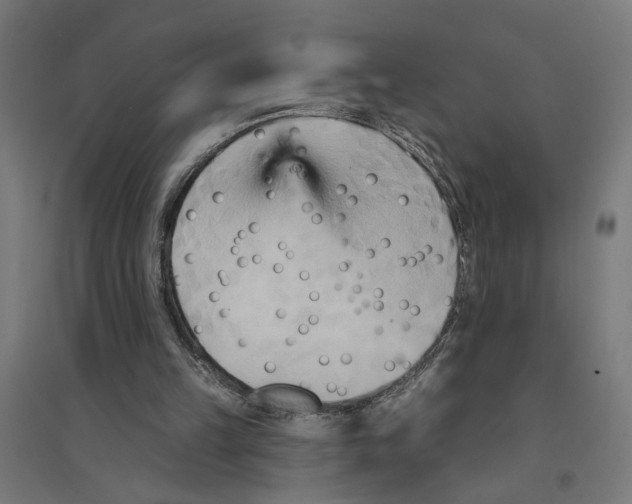 X0000094420149200712061059