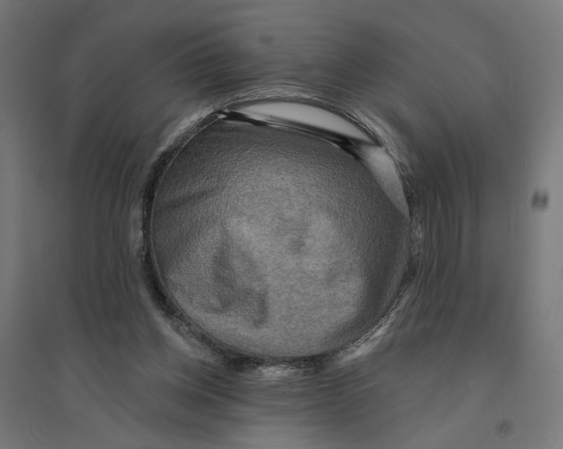 X0000094420158200712061059