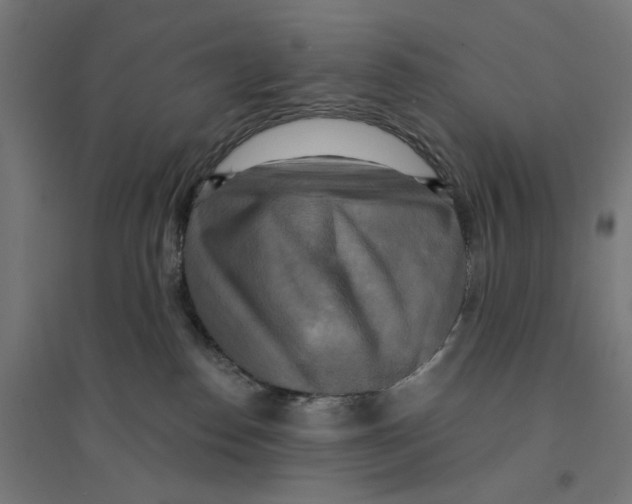 X0000094420186200712061100