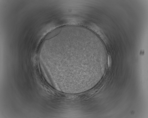 X0000094430579200712061116