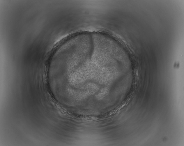 X0000094431158200712061107