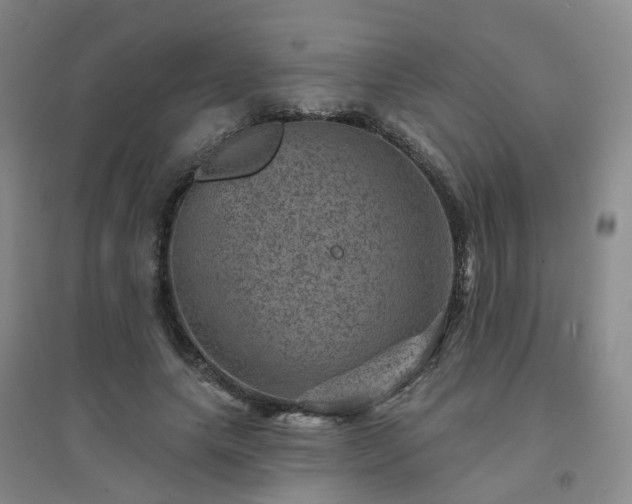 X0000094440639200711151406
