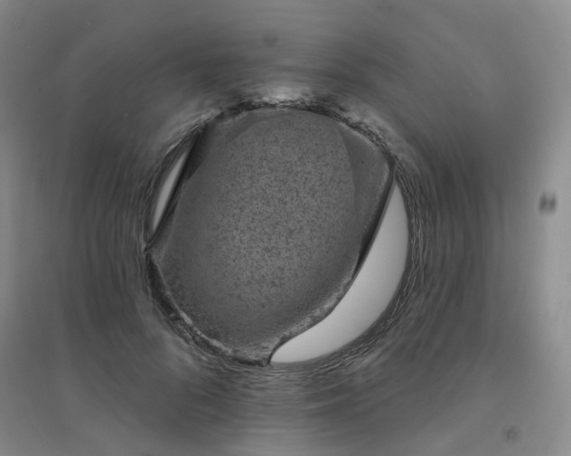X0000094440696200711151405