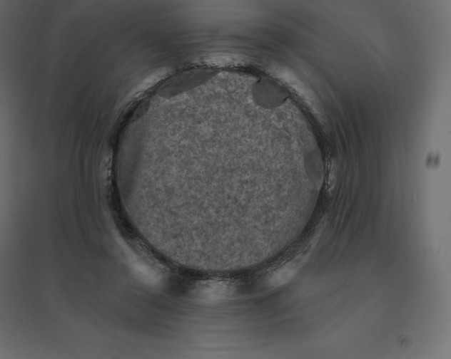 X0000094440356200711211501