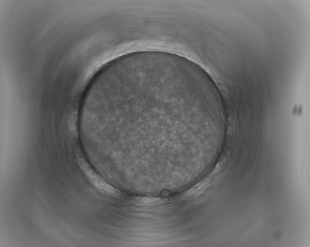 X0000094441499200711291623