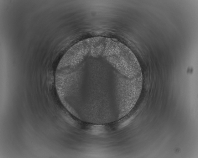 X0000094440085200712061148