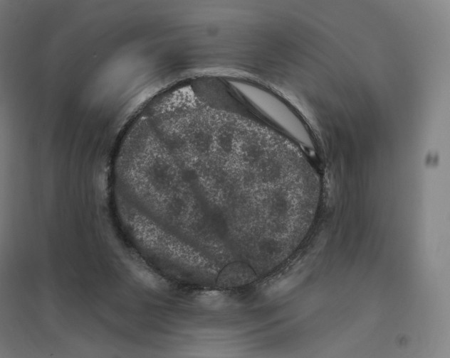 X0000094440111200712061147