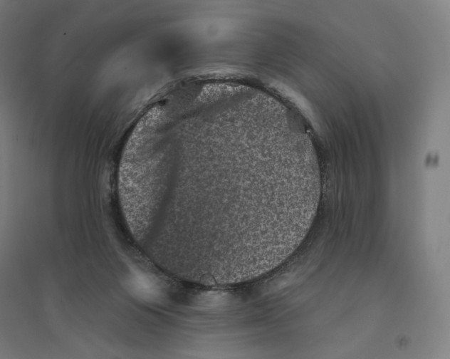 X0000094440119200712061147