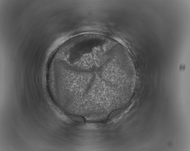 X0000094440149200712061146