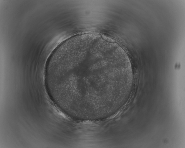 X0000094440290200712061144