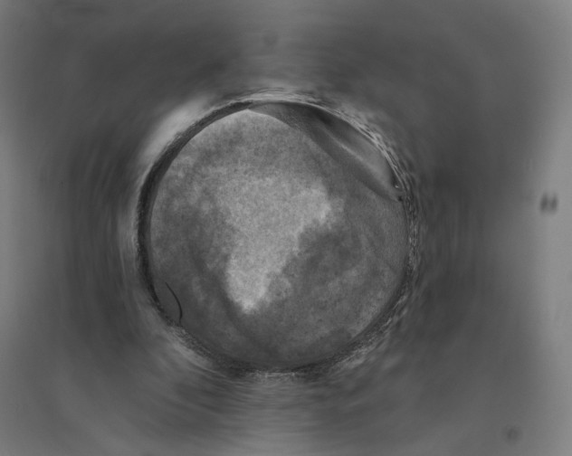 X0000094440296200712061144