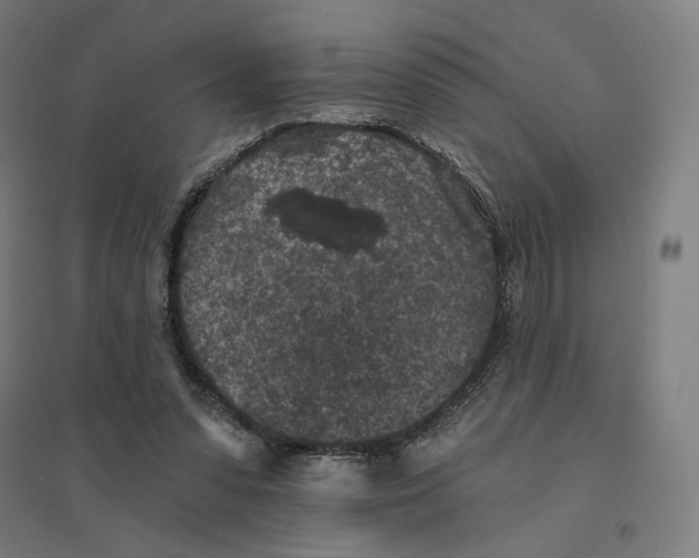 X0000094440303200712061144