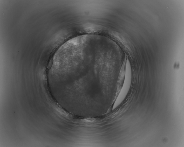 X0000094440317200712061144