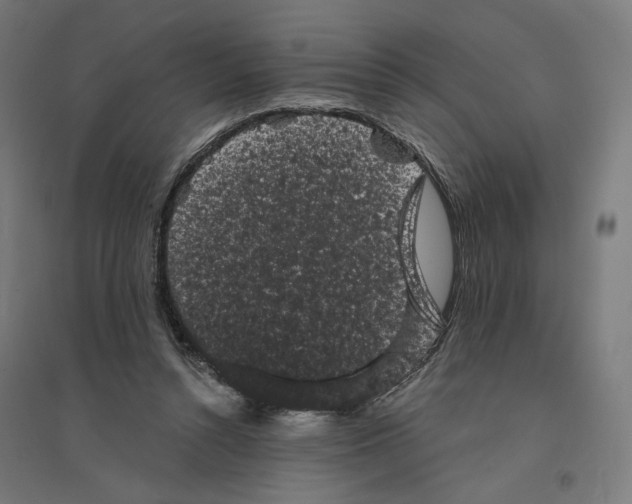 X0000094440352200712061143