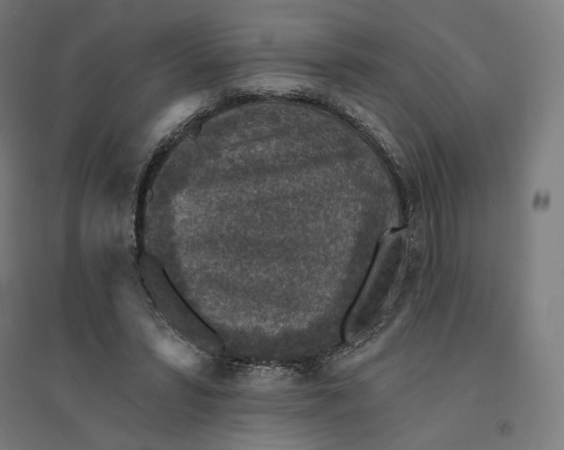 X0000094440399200712061143