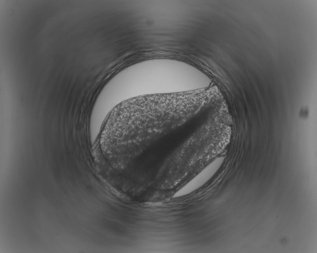 X0000094440425200712061142