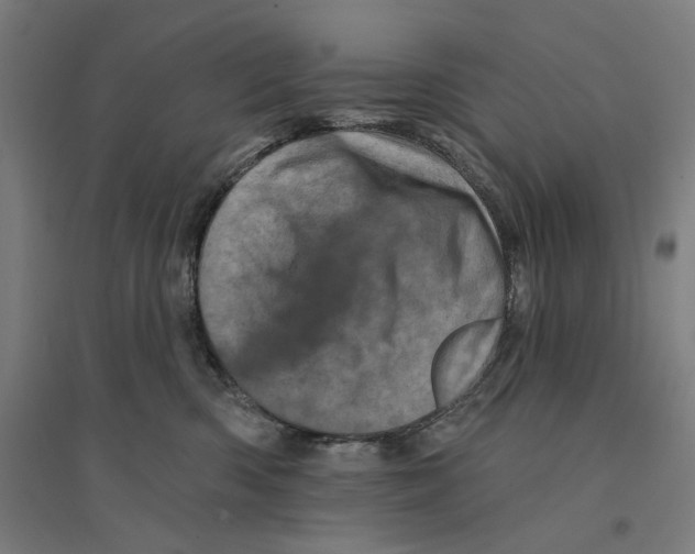 X0000094440426200712061142