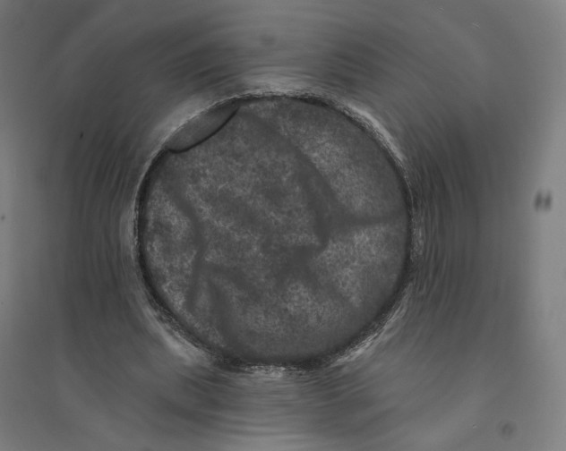 X0000094440439200712061141