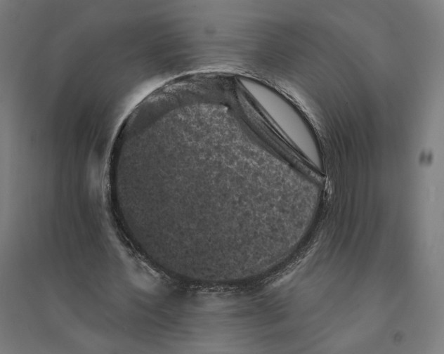 X0000094440532200712061140