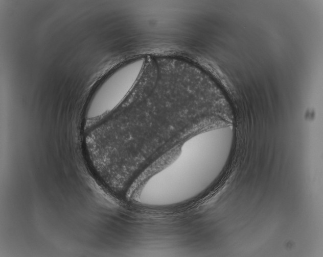 X0000094440585200712061140