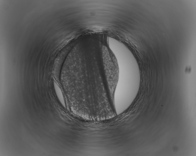 X0000094440868200712061135