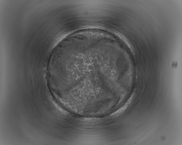 X0000094440985200712061133