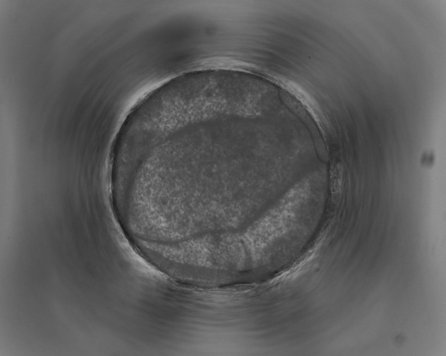 X0000094440987200712061133