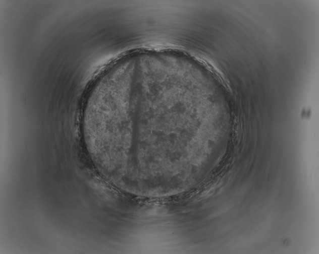 X0000094441016200712061132