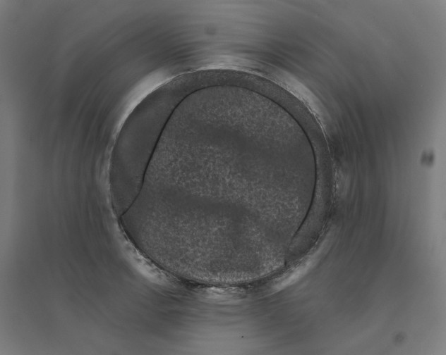 X0000094441138200712061131