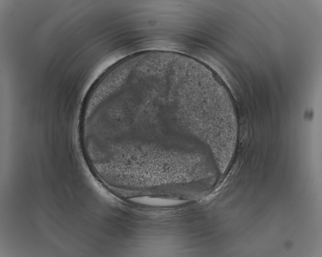 X0000094441139200712061131