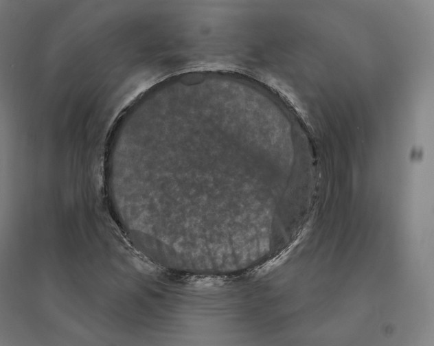 X0000094441165200712061130