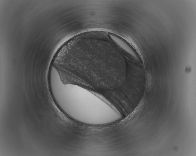 X0000094441181200712061130