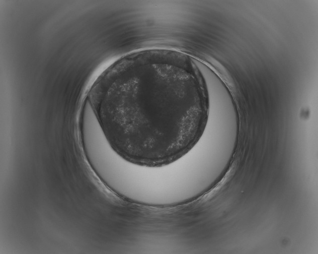 X0000094441196200712061130