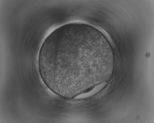 X0000094441199200712061130