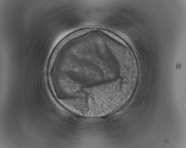 X0000094441440200712061127