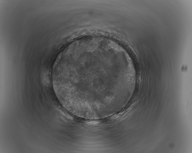 X0000094441490200712061124