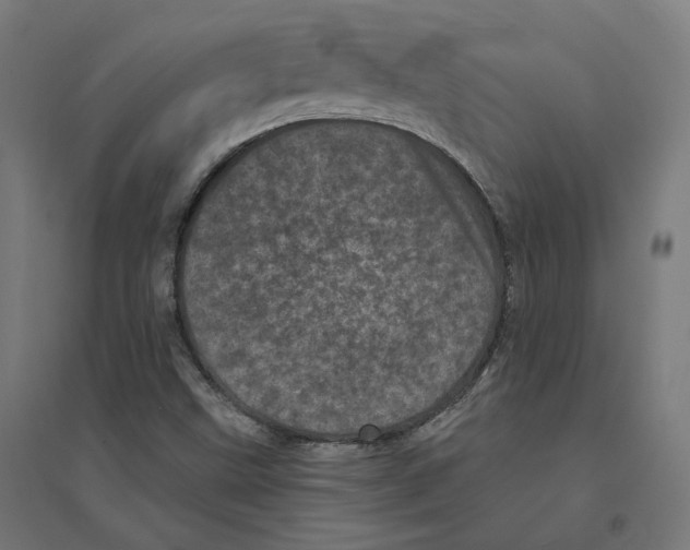 X0000094441499200712061124