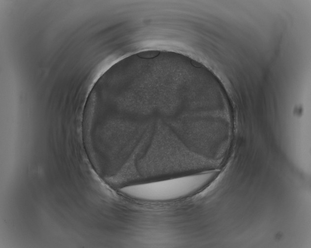 X0000094441529200712061125