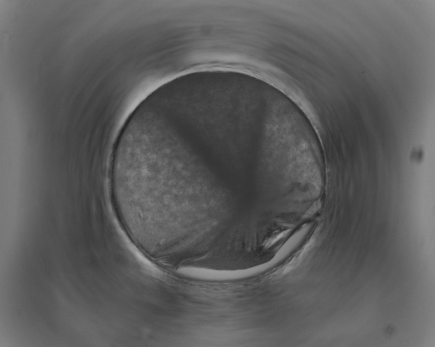 X0000094441533200712061125