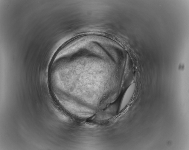 X0000094450148200711291707