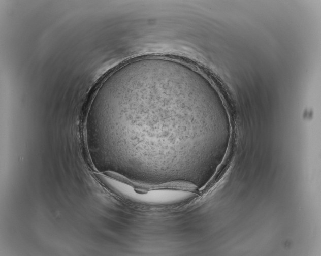 X0000094451497200711291647