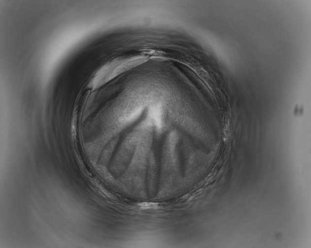 X0000094450052200712061209