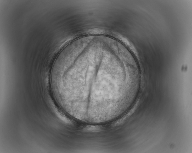 X0000094450057200712061209