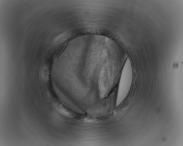 X0000094450080200712061210