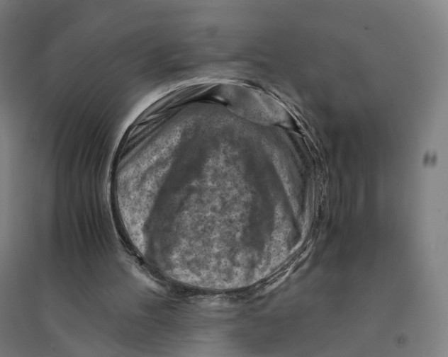 X0000094450100200712061209