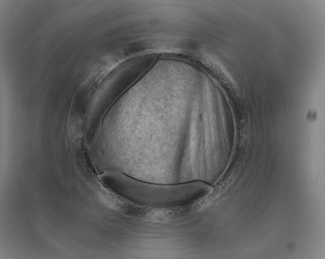 X0000094451169200712061154