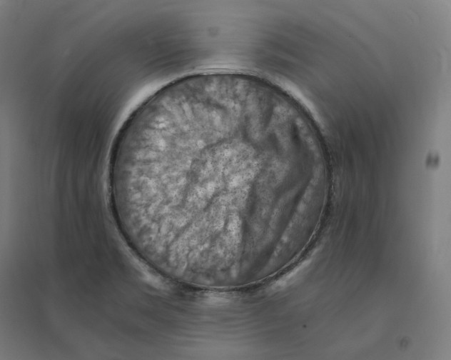 X0000094451469200712061150